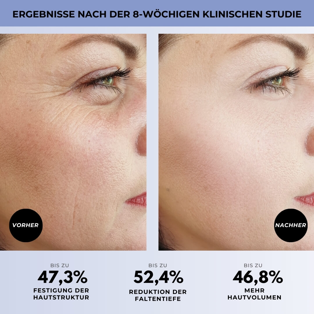Vorher-Nachher Ergebnisse 