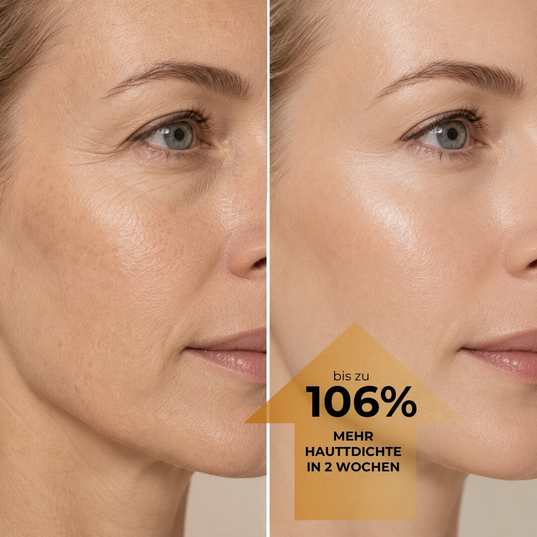 Anti-Melanin Hautpflege behandelt gleichzeitig Elastizitätsverlust und Pigmentflecken
